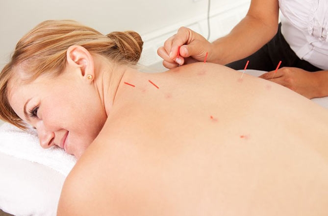 acupuncture-side-effects-post_feature_669x444